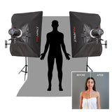 LUMI400II Medical Clinical Wall Mounted Photography Studio Flash Kit (Before and After)