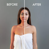 Image Taken Using LUMI400II Medical Clinical Aesthetic Photography Studio Flash Kit (Before and After)